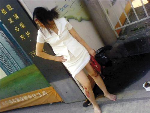 撞人司机绝尘而去路人甲乙停车施救